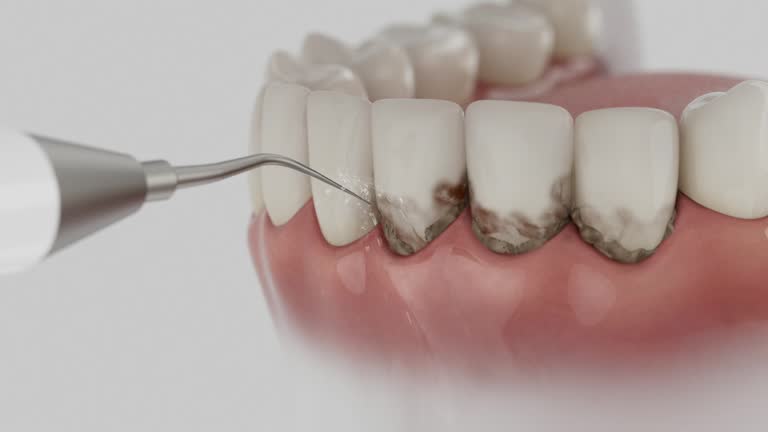 Trusted Tooth Extraction service in Fairwood, MD - Dentist Open Now